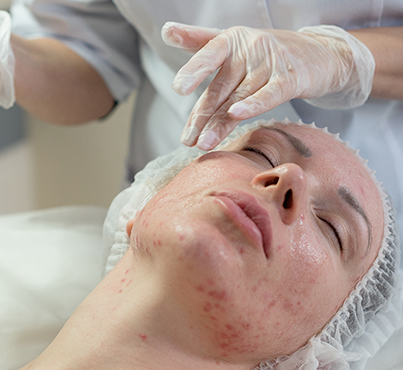 procedure-sub-image